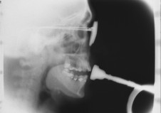 Watson Studies in Diagnostic Cinefluorography still 01 trumpet smaller